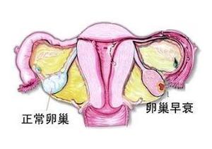 女性卵巢囊肿对生育有什么影响吗