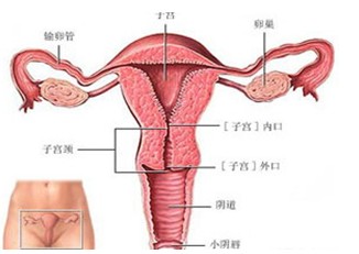 子宫内膜异位症